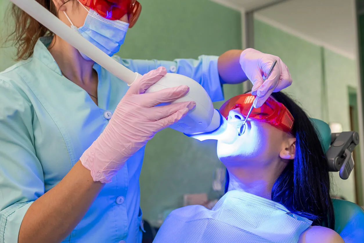 blanqueamiento dental santiago centro